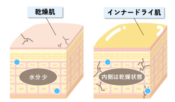 2タイプの乾燥肌