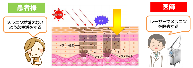 シミ治療中のスキンケア