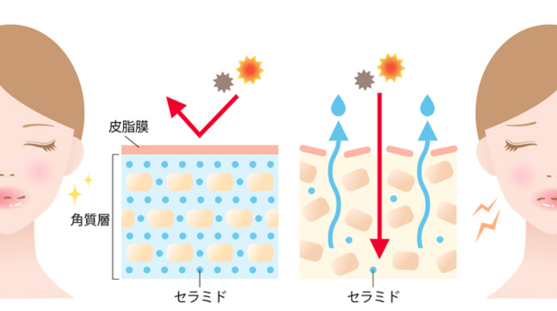 乾燥対策の基本とスキンケア