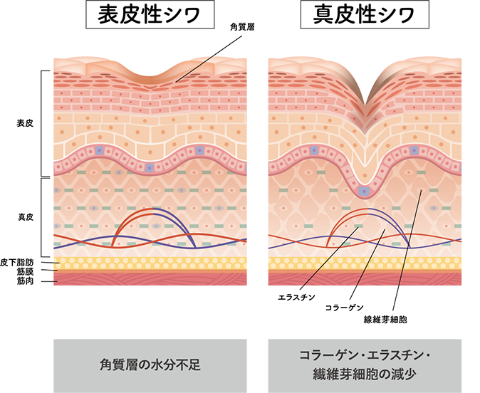 シワ