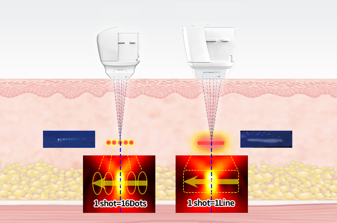 ウルトラセルZi
