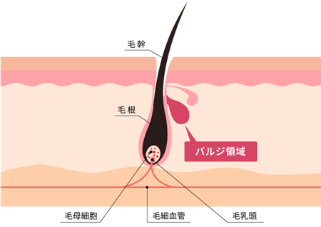 子供医療レーザー脱毛