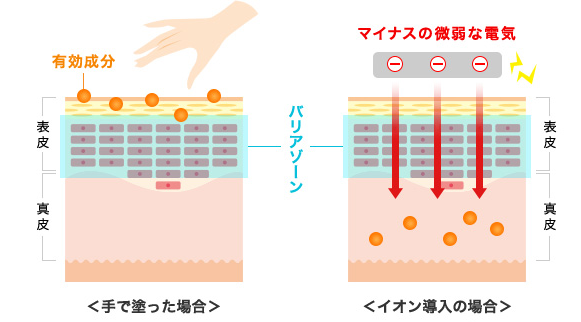 イオン導入