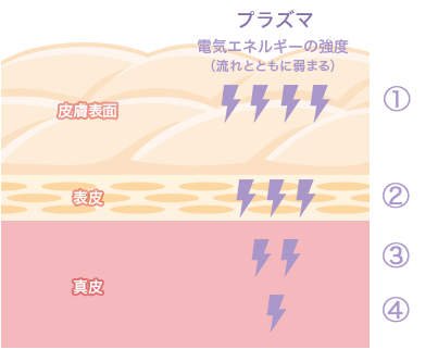 プラズマシャワー