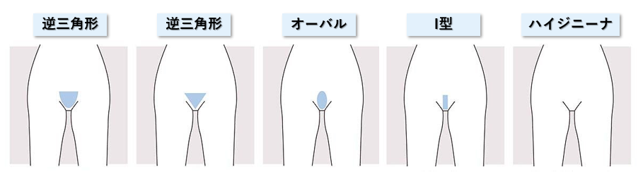 VIO医療レーザー脱毛